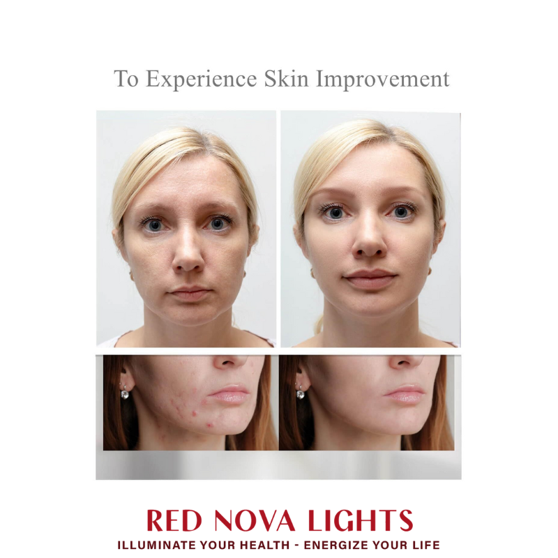 Red Nova Lights LED Face Mask – Red, Blue, Yellow & Near-Infrared Light